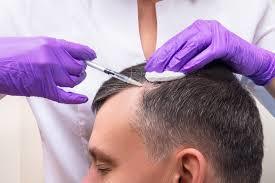 Hair Transplant (5).jpg